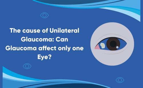 The cause of Unilateral Glaucoma: Can Glaucoma affect only one Eye? 
