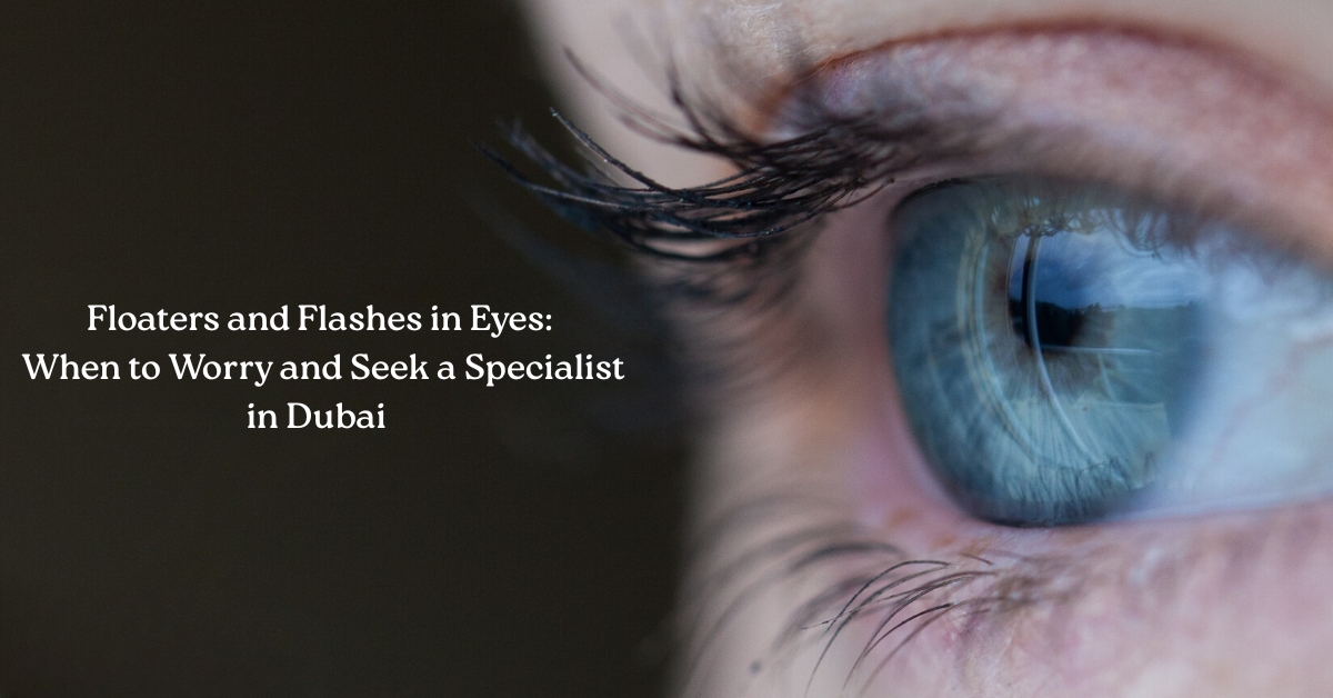 Floaters Flashes in Eyes Dubai Warning Signs